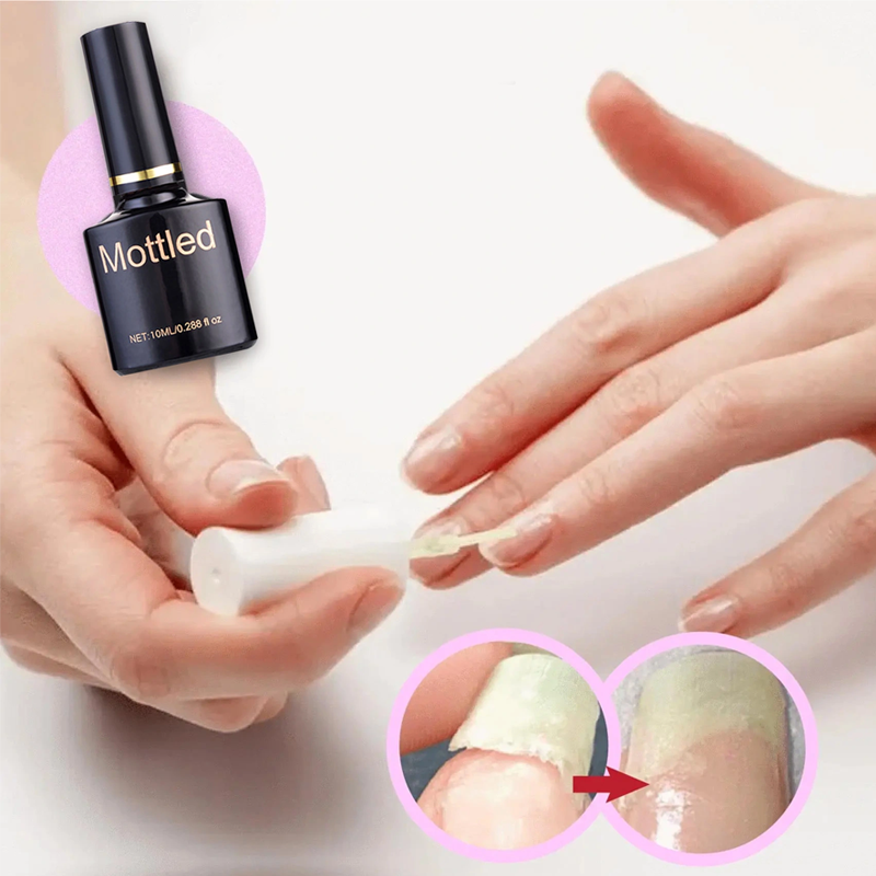 🔥2024 Summer Hot Sale🔥NAIL REPAIR PROTECTION GEL